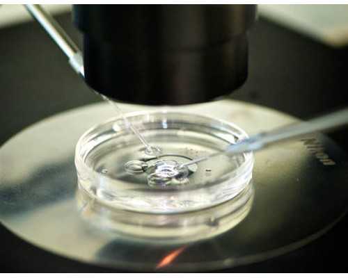 国内供卵私人机构有哪些,分析杰特宁三代试管婴儿能排除唐氏吗!3-10万不等!